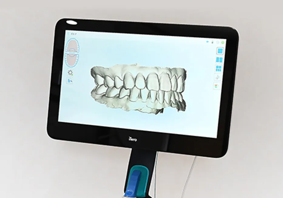 iTero